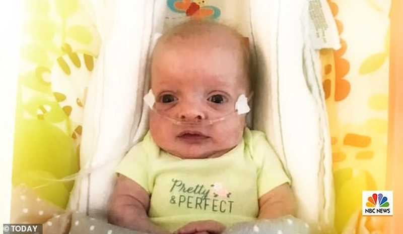 A bebê Gisele quando ainda estava internada no hospital. Foto: Reprodução / Today